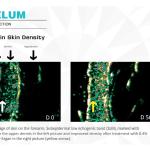 FACELUM