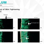 FACELUM