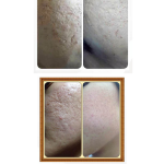FACELUM