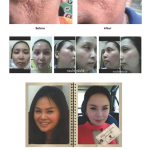 FACELUM